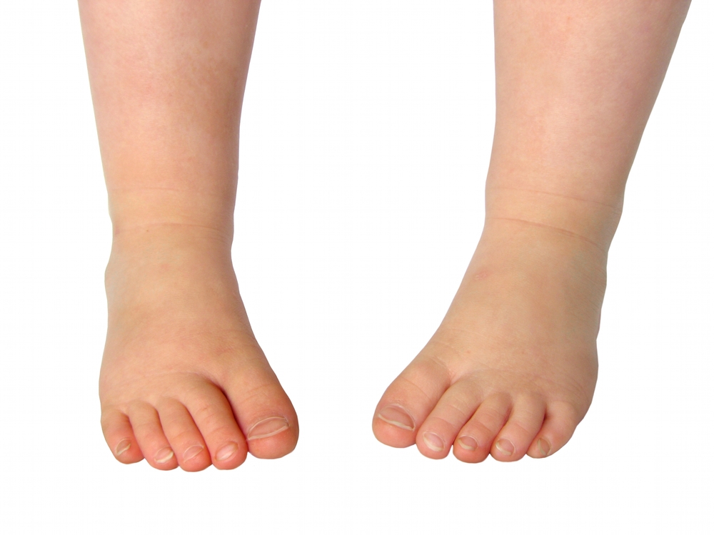 Desarrollo del pie en la infancia