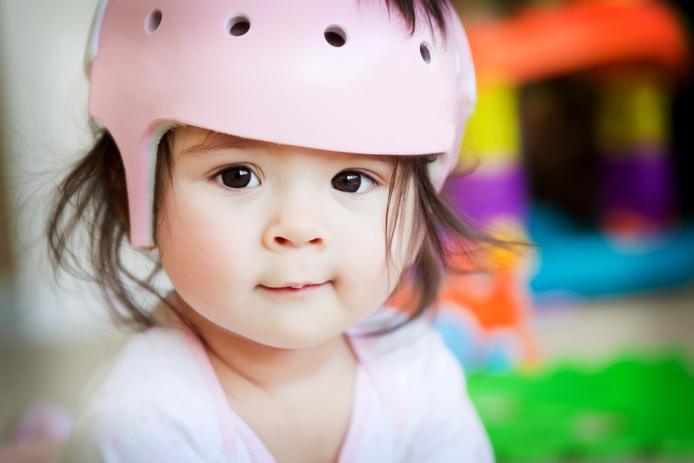 Se puede evitar el casco ortopédico en bebés? La respuesta es SÍ.