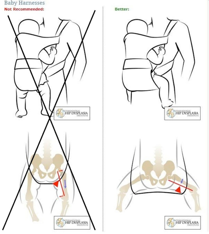 Porteo ergonómico y cuidado de la espalda - Instituto Cirugía de
