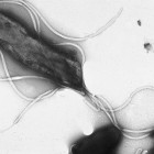 Helicobacter pylori al microscopio electrónico. Fotografíad e Yutaka Tsutsumi