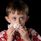 Niño sangrando por la nariz