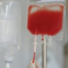 Transfusión de células hematopoyéticas