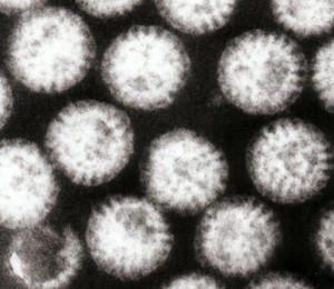 Rotavirus. Imagen de GrahamCol procedente de http://en.wikipedia.org/wiki/File:Multiple_rotavirus_particles.jpg