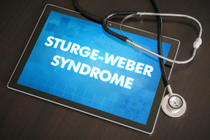 Síndrome de Sturge Weber 