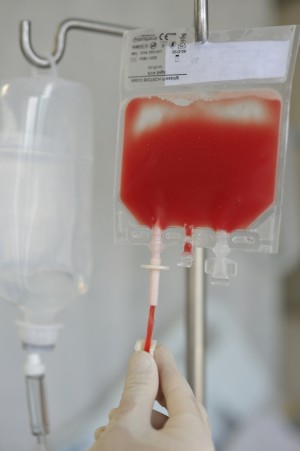 Transfusión de células hematopoyéticas